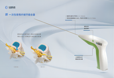 新品推介|康盛一次使用纤维环缝合器